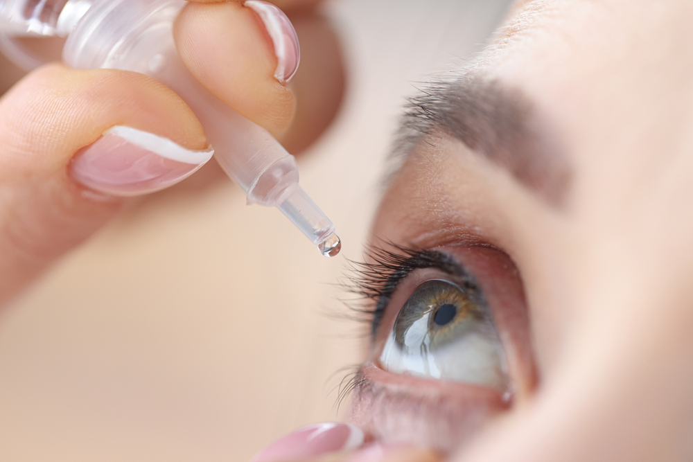 Woman,Drips,Eye,Drops,Into,Her,Eyes.,Eye,Diseases,And